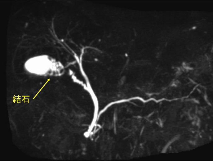 臨床試験の段階